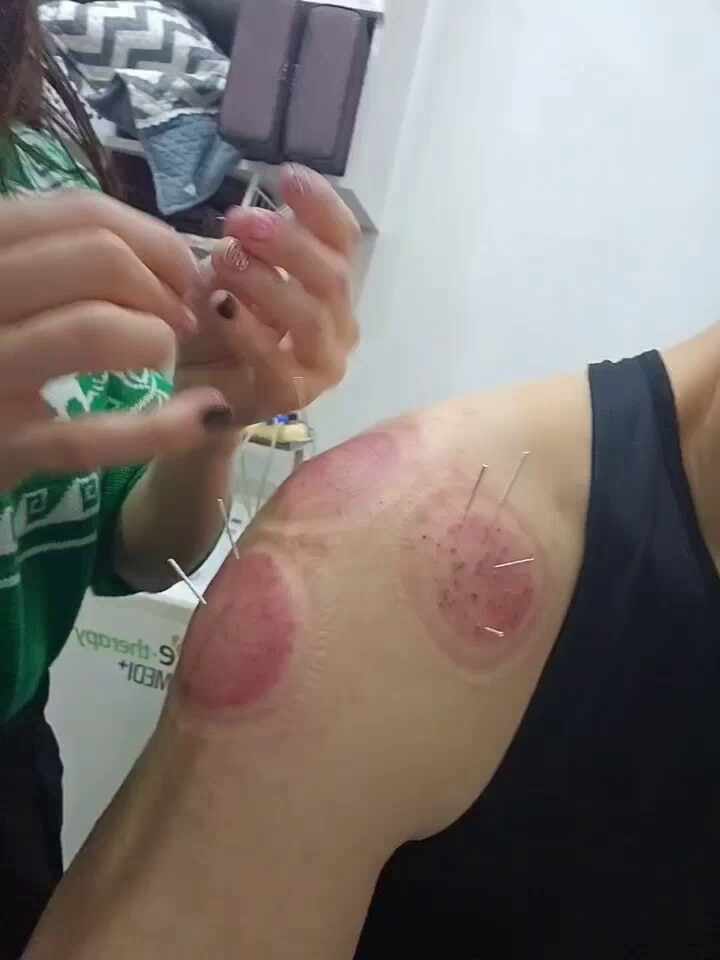 인천송도 더율한의원