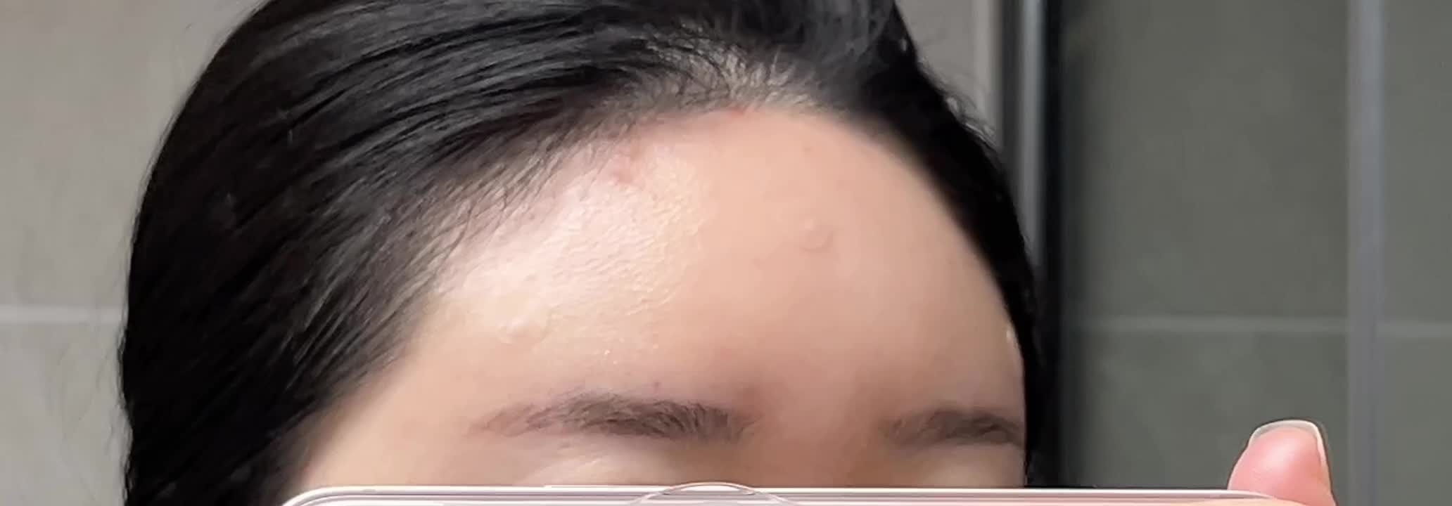 미엘르의원 부산서면