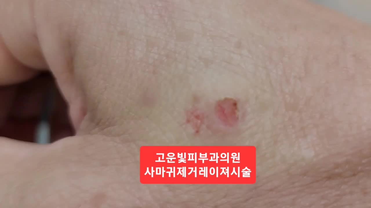 고운빛피부과의원