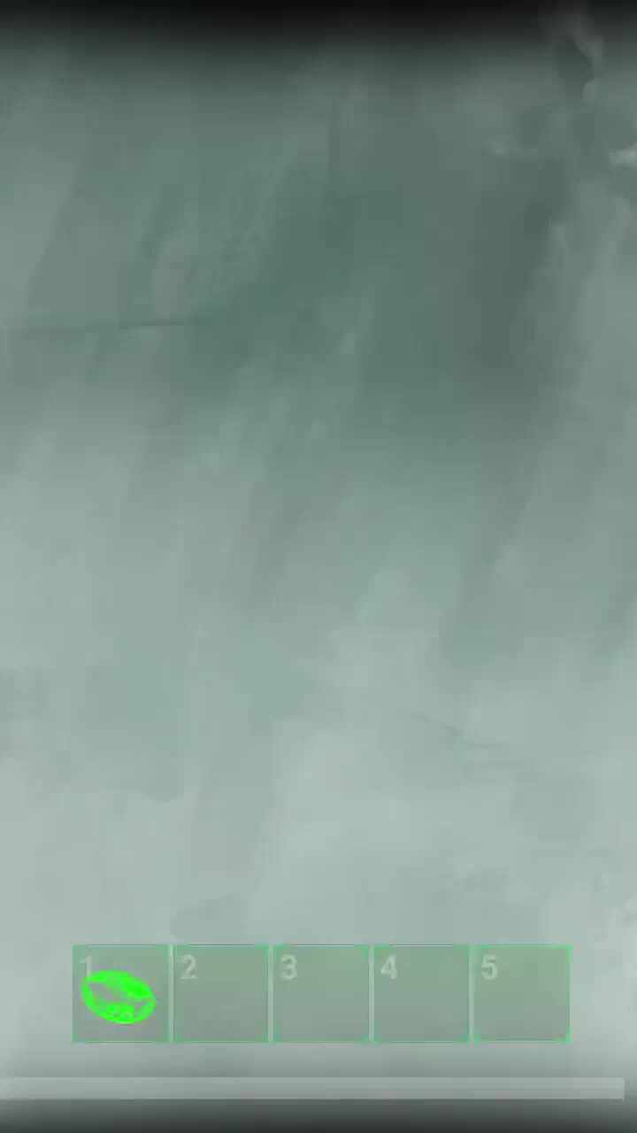 윽...옥....