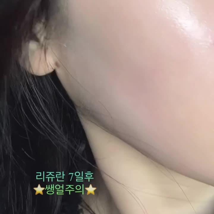 오아로피부과의원 청량리