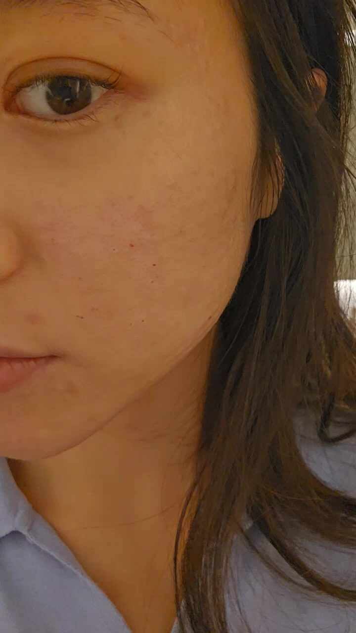 서울바른피부과의원