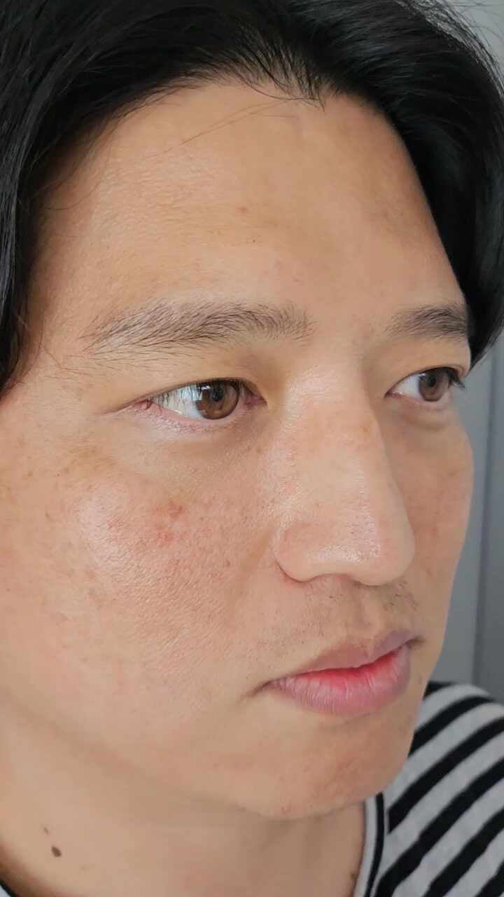내안에봄의원 일산