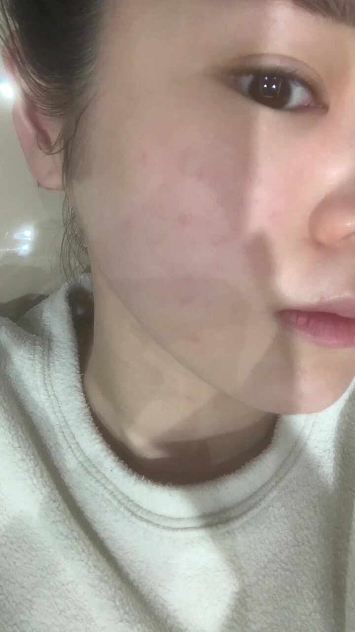 올림 피움 채움 올피채의원 강서