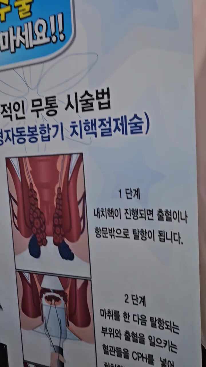 속초항맥외과 2