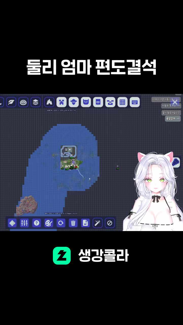 둘리 엄마 편도결석