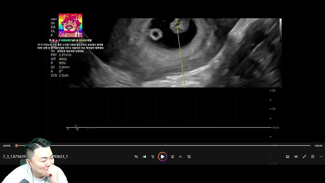 아로한테 로키 2세 조기교욱을 맡기면