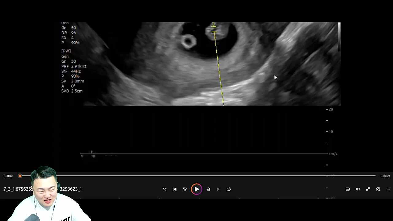 숀쟝 치즈 리액션은 터미널로